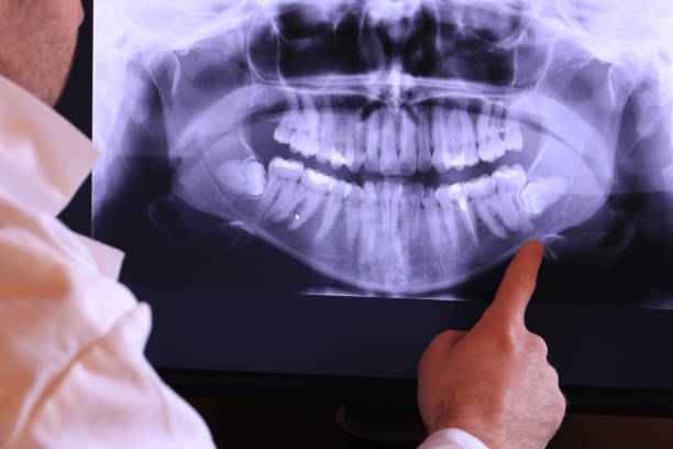 Best Emergency Gum Pain Relief  in Lonville, GA
